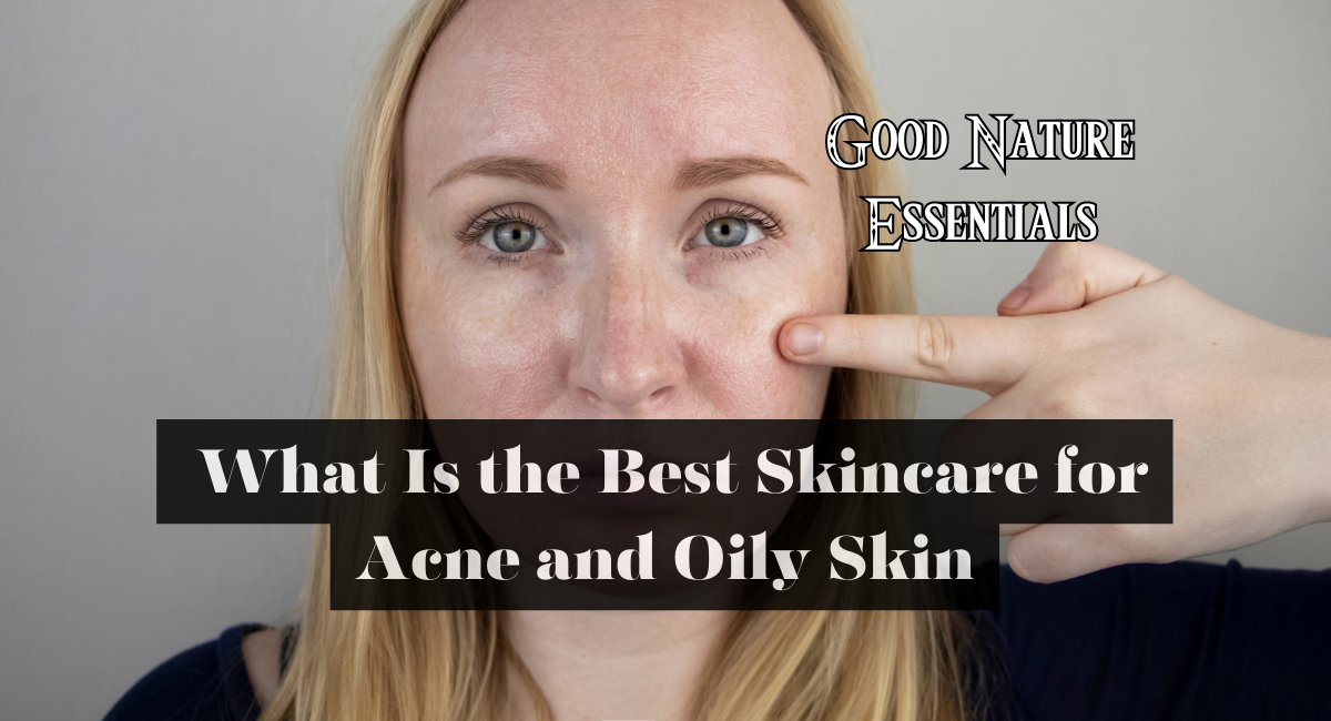 What Is the Best Skincare for Acne and Oily Skin